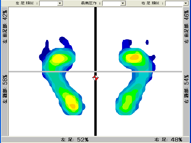 仙骨調整前に測定