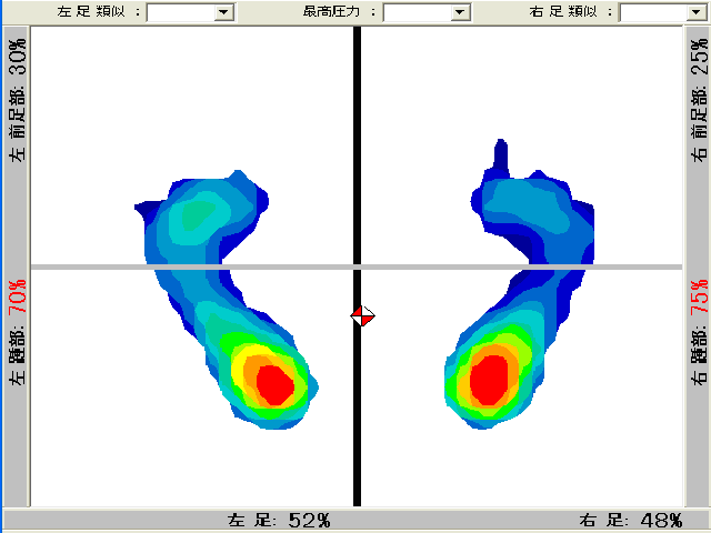 仙骨調整直後に測定